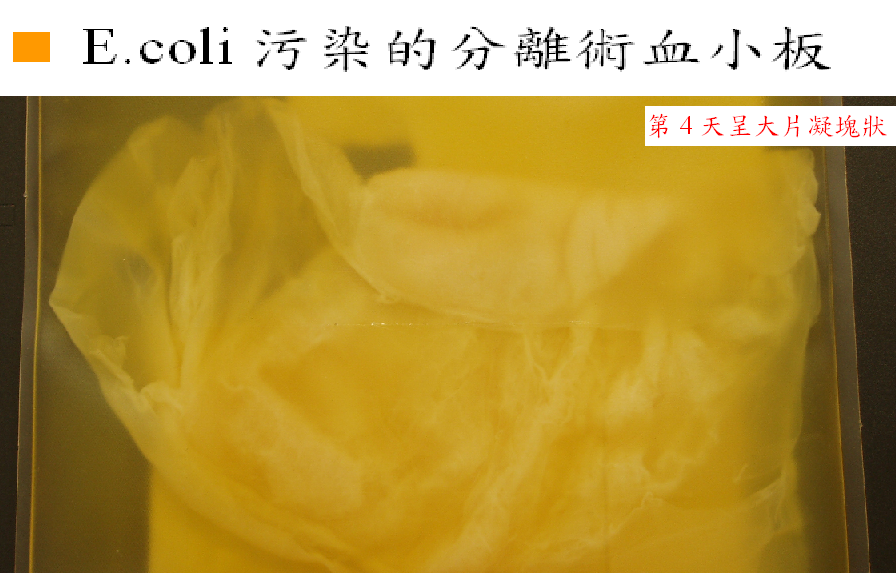 血袋陽性細菌檢測照片【E.coli污染的分離術血小版】2