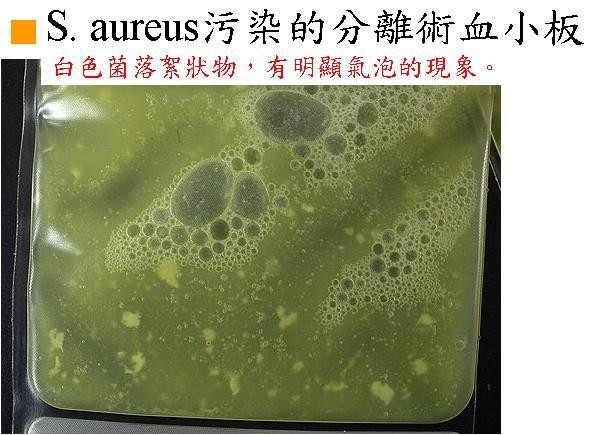 血袋陽性細菌檢測照片【S.aureus污染的分離術血小板】