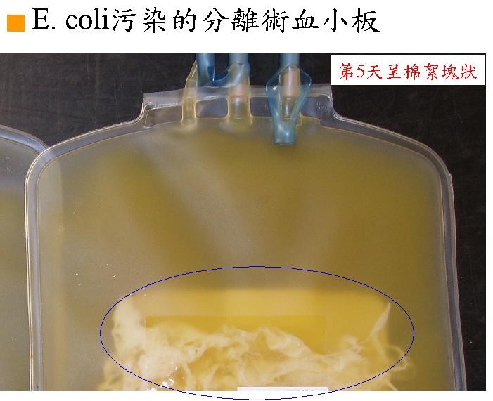 血袋陽性細菌檢測照片【E.coli污染的分離術血小版】