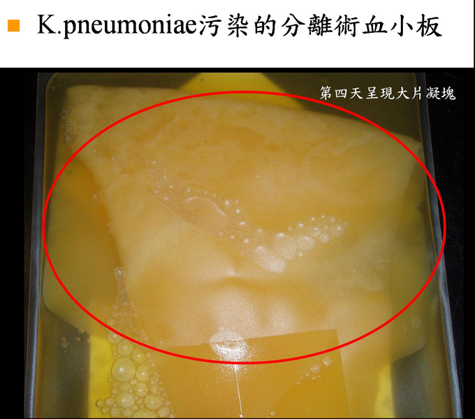 血袋陽性細菌檢測照片【K.pneumoniae污染的分離術血小板】2