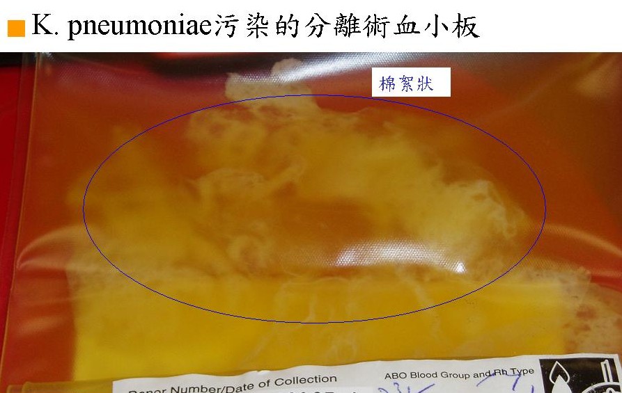 血袋陽性細菌檢測照片【K.pneumoniae污染的分離術血小板】